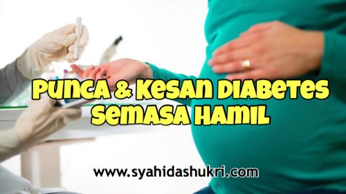Kenali punca dan kesan diabetes semasa hamil